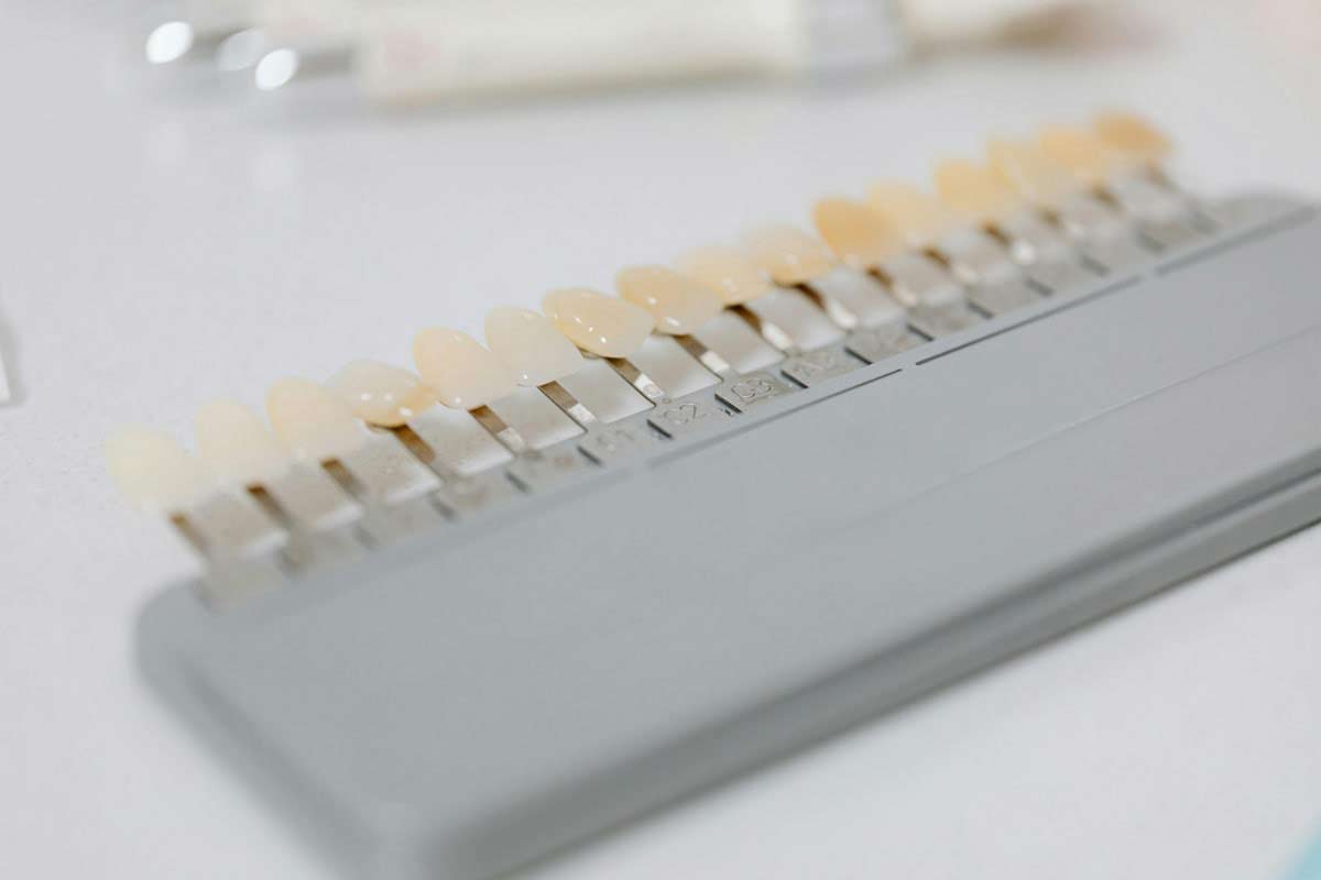 closeup look at different shades of dental veneers