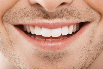closeup of a man's freshly whitened smile